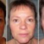 Naturlig ansigtsløft japansk lifting