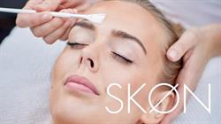 Skøn