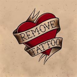 Removetattoo.dk