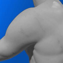 Løfholm Osteopati